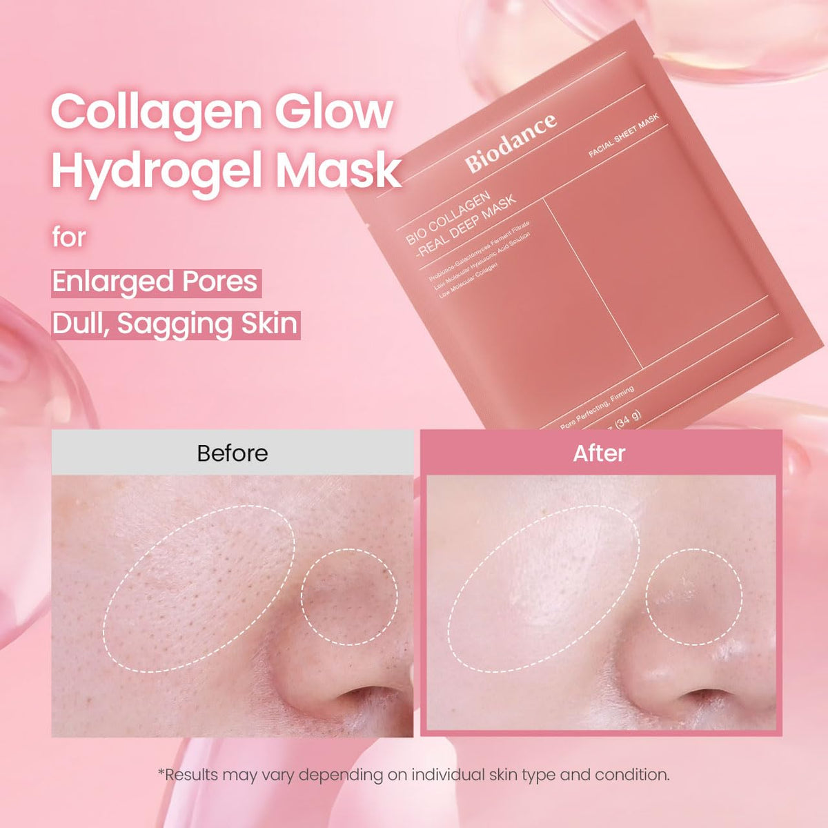 BIODANCE Bio-Collagen Real Deep Mask – Overnight Hydrogel Facial Sheet Mask for Deep Hydration, Pore Minimizing & Skin Firming – Low Molecular Collagen & Hyaluronic Acid (4 Masks)